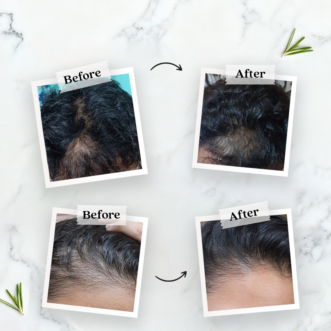 Rosemary Hair Care Kit